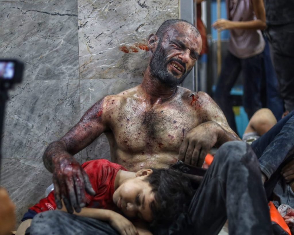 Un uomo ferito tiene tra le braccia un bambino in un ospedale di Gaza, dopo un bombardamento. Una scena dal documentario Inside Gaza (History Channel, 2024)